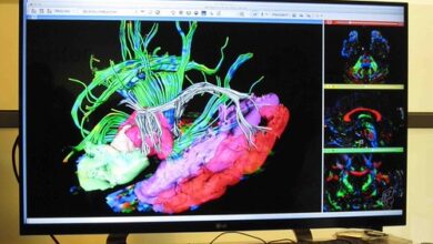 Allen Institute for Brain Science