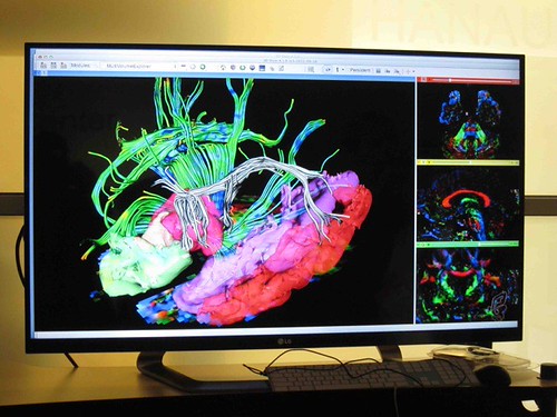 Allen Institute for Brain Science